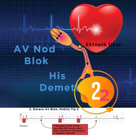 Prof. Dr. Çağlar: Covid-19’un neden olduğu kalp-damar komplikasyonları kalıcı olabilir!